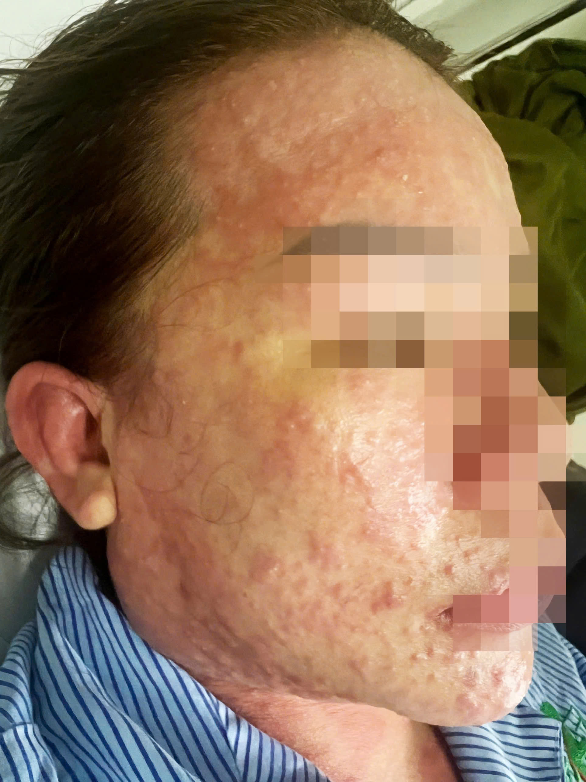 Một phụ nữ su&yacute;t chết khi uống collagen, thuốc giảm c&acirc;n mua tr&ecirc;n mạng- Ảnh 1.