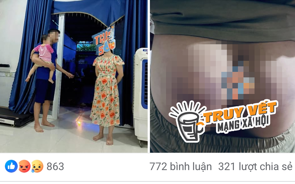 Công an xác minh thông tin cô giáo đánh học sinh bầm tím mông