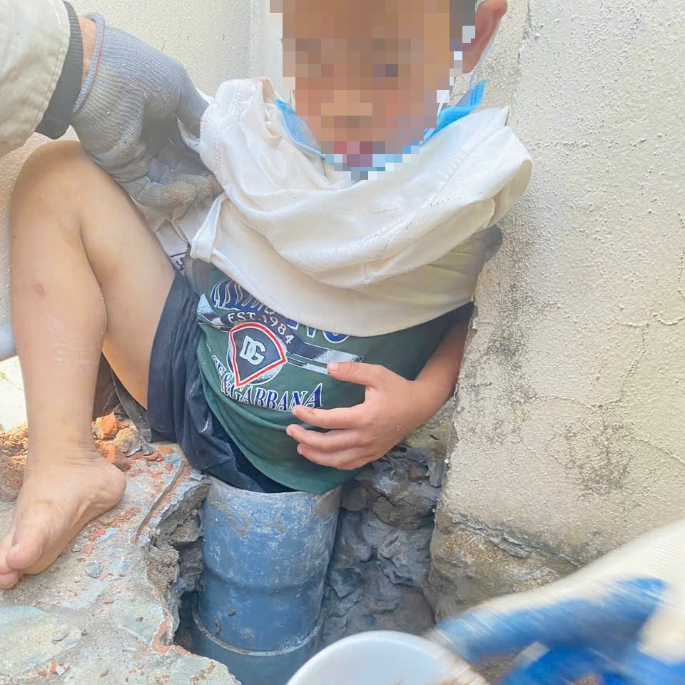 Cháu bé 5 tuổi gặp nạn hy hữu - Ảnh 1.
