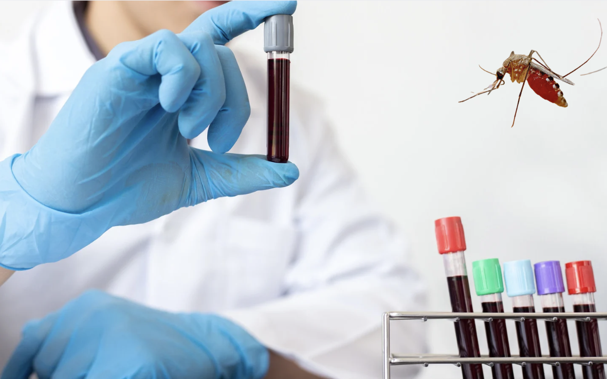 Có nên đi xét nghiệm Chikungunya?