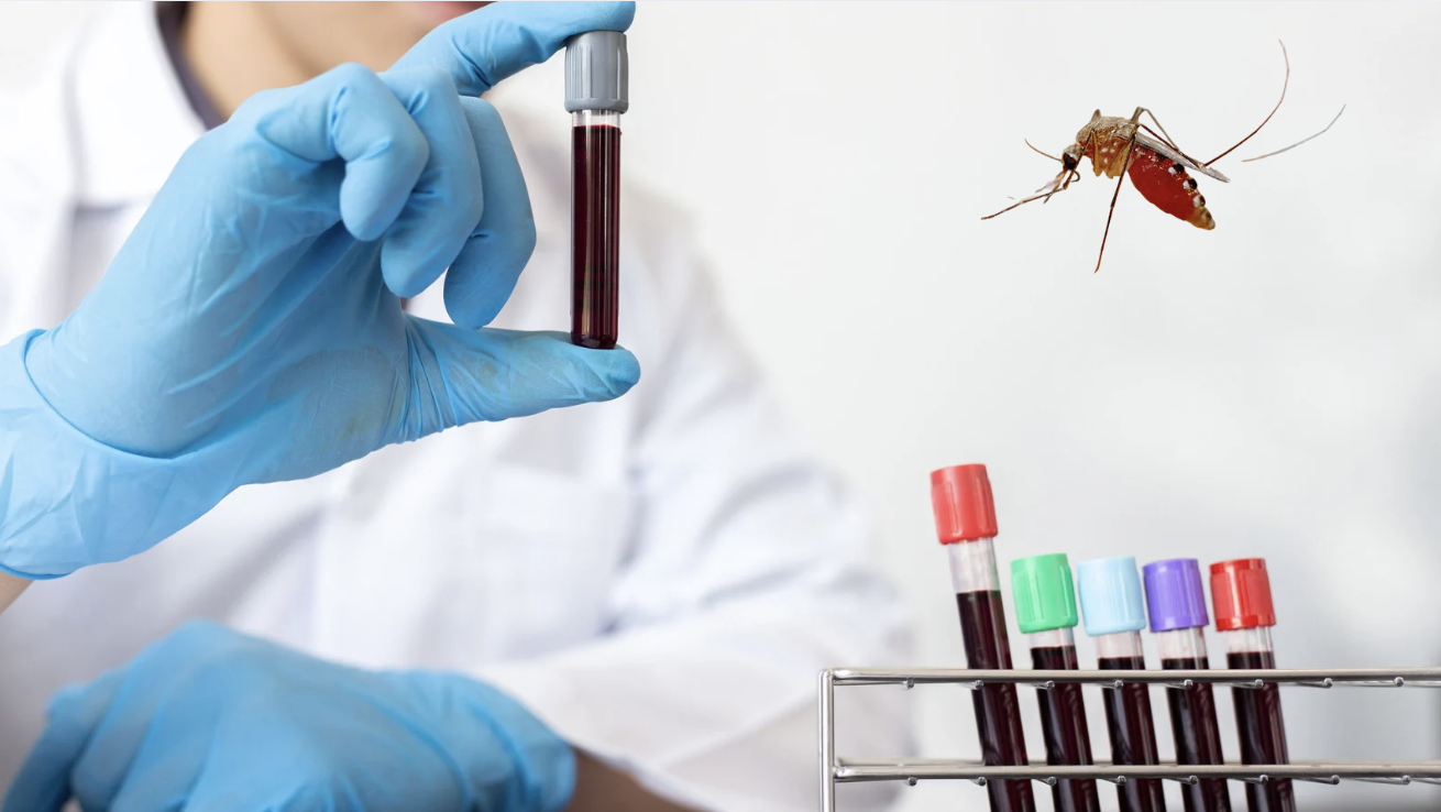 C&oacute; n&ecirc;n đi x&eacute;t nghiệm Chikungunya? - Ảnh 1.