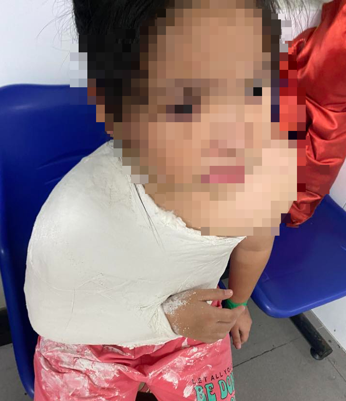 Nhiều trẻ g&atilde;y tay , ch&acirc;n tại khu vui chơi nh&agrave; văn h&oacute;a lao động Quảng Ng&atilde;i - Ảnh 3.