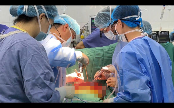 Kỳ tích ca ghép tim - phổi đầu tiên tại Việt Nam - Ảnh 1.