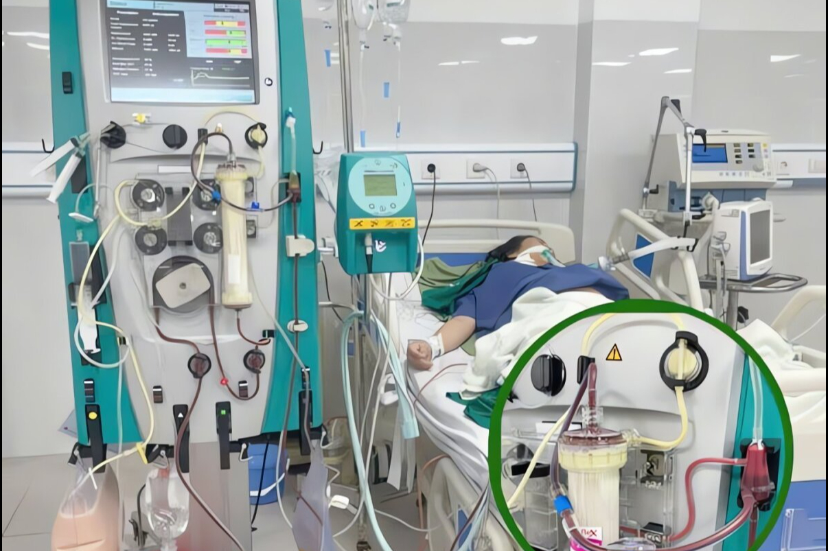 Mổ bắt con khẩn cấp, lọc máu cứu sản phụ vì biến chứng bất ngờ- Ảnh 2.