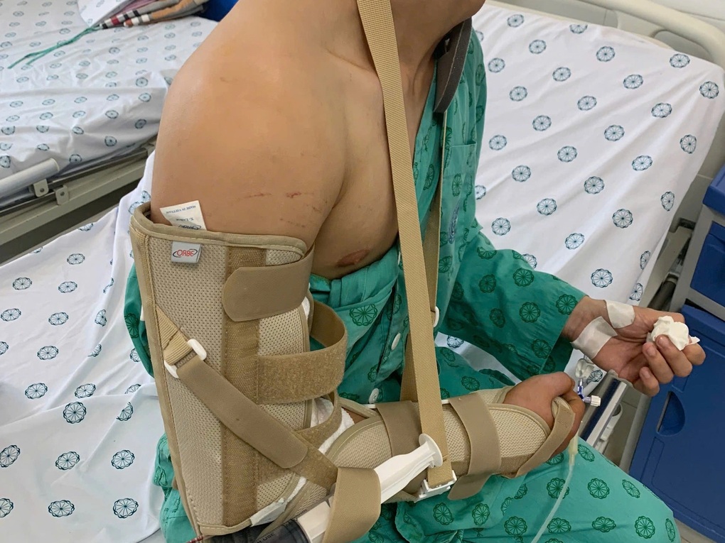 Chơi vật tay với bạn, nam sinh bị g&atilde;y xương- Ảnh 1.
