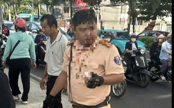 Phân định pháp lý vụ một Trung tá CSGT bị thanh niên người Nga tấn công
