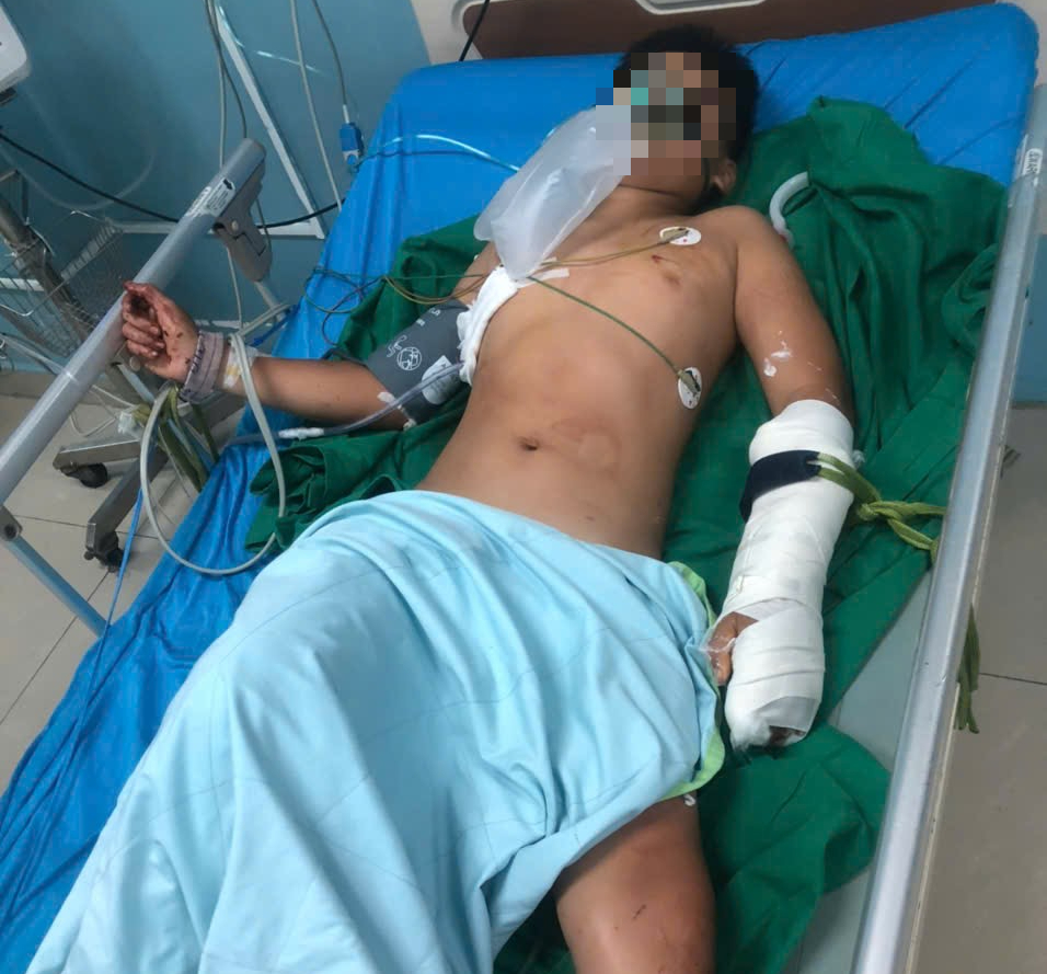 Vụ thảm &aacute;n Đắk Lắk: Ch&aacute;u trai 13 tuổi tho&aacute;t chết kỳ diệu Sau khi bị đ&acirc;m - Ảnh 1.