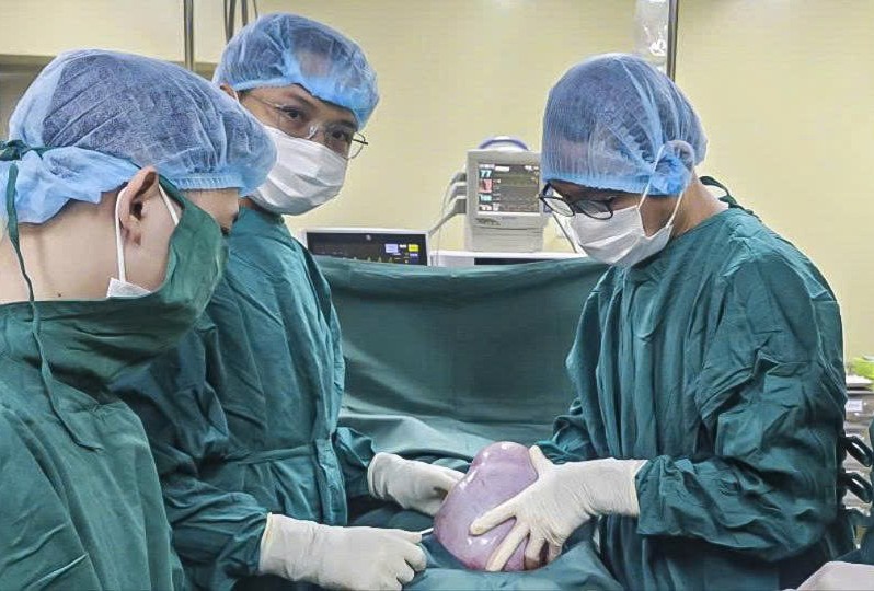 Khối u buồng trứng "khổng lồ" nặng 5,5 kg trong bụng cô gái 19 tuổi - Ảnh 1.