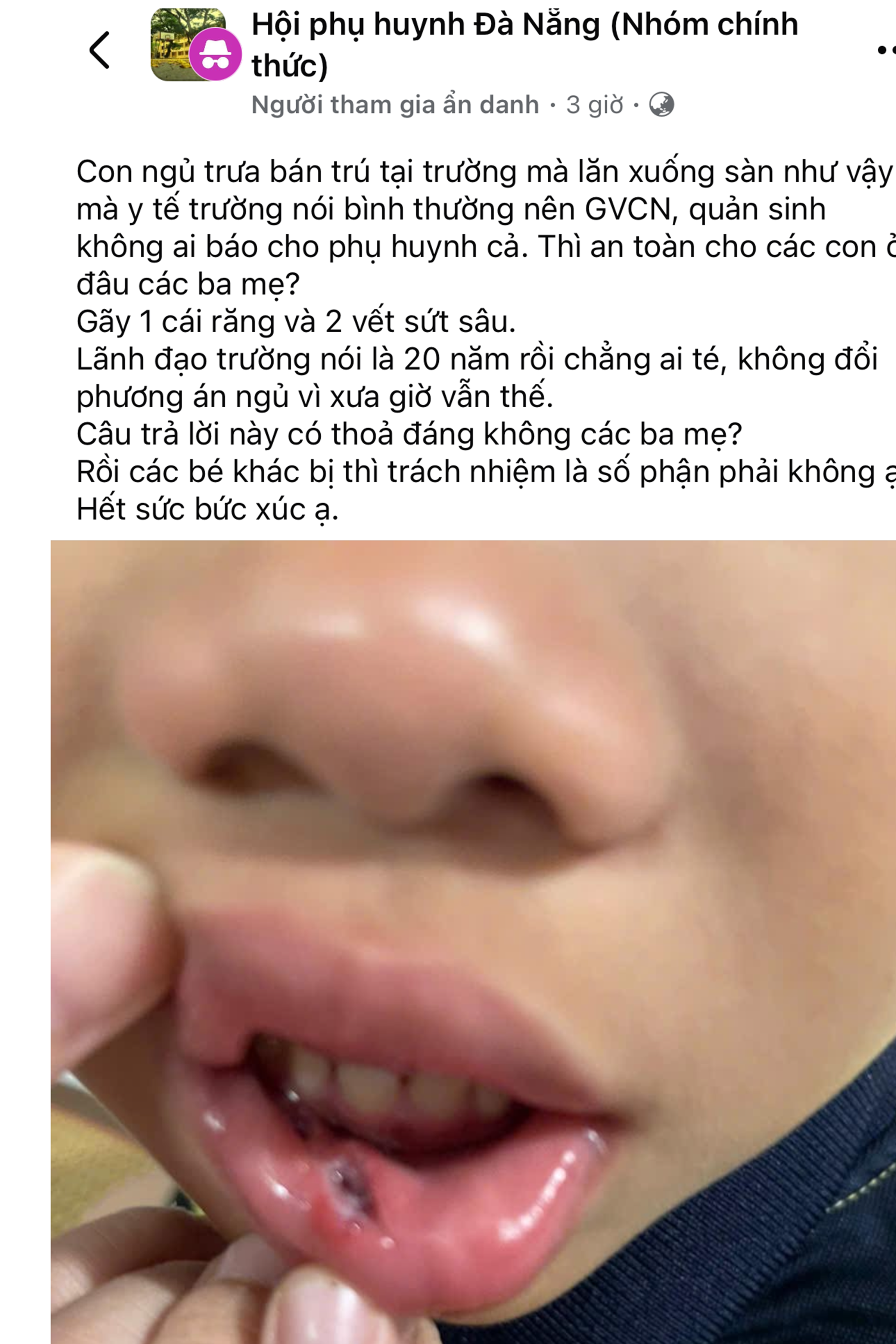 Đ&agrave; Nẵng: L&atilde;nh đạo trường tiểu học l&ecirc;n tiếng việc học sinh ng&atilde; xuống đất giờ ngủ trưa - Ảnh 1.