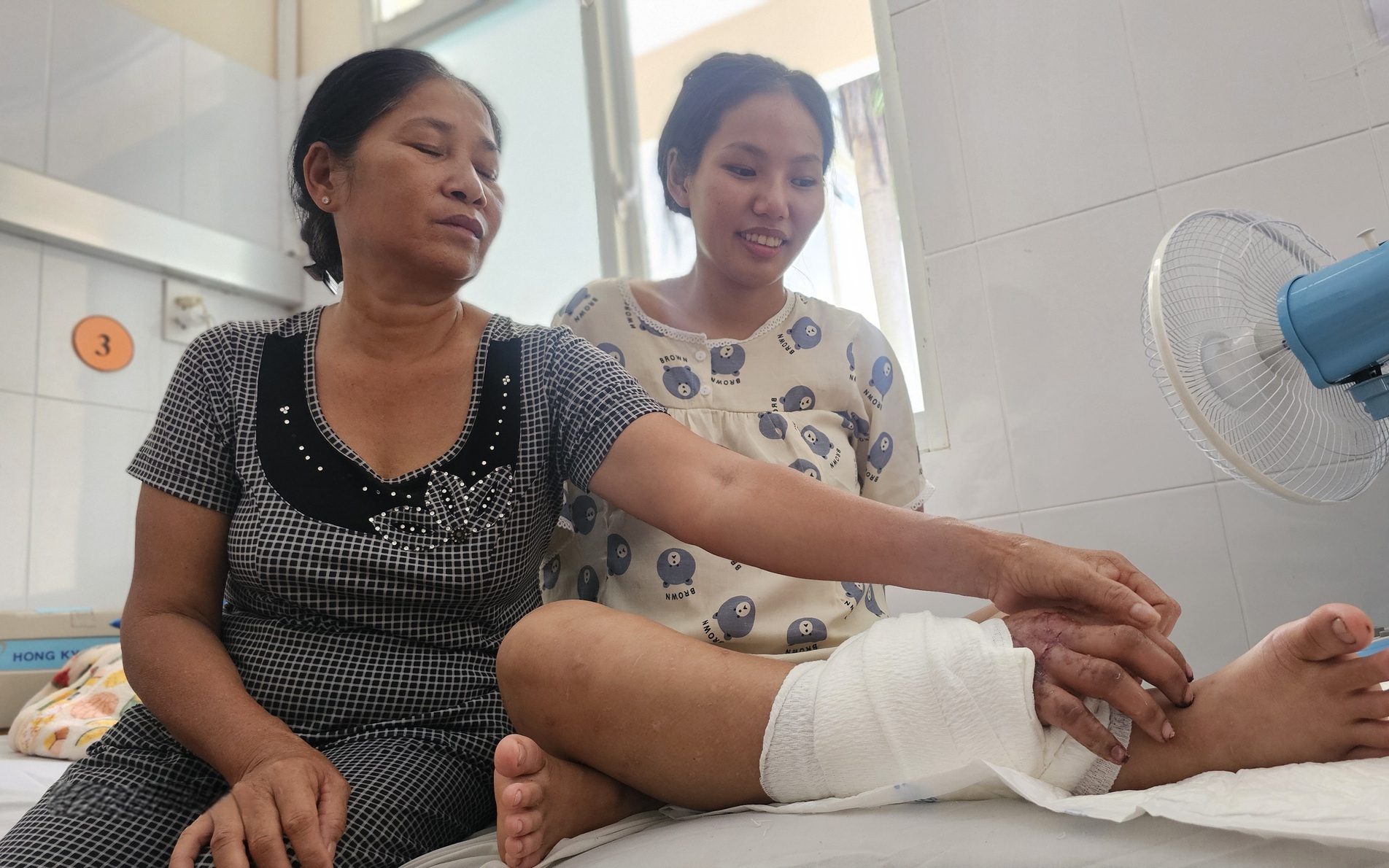 Ghép bàn tay vào chân cho cô gái 18 tuổi mang song thai để chờ ngày nối lại