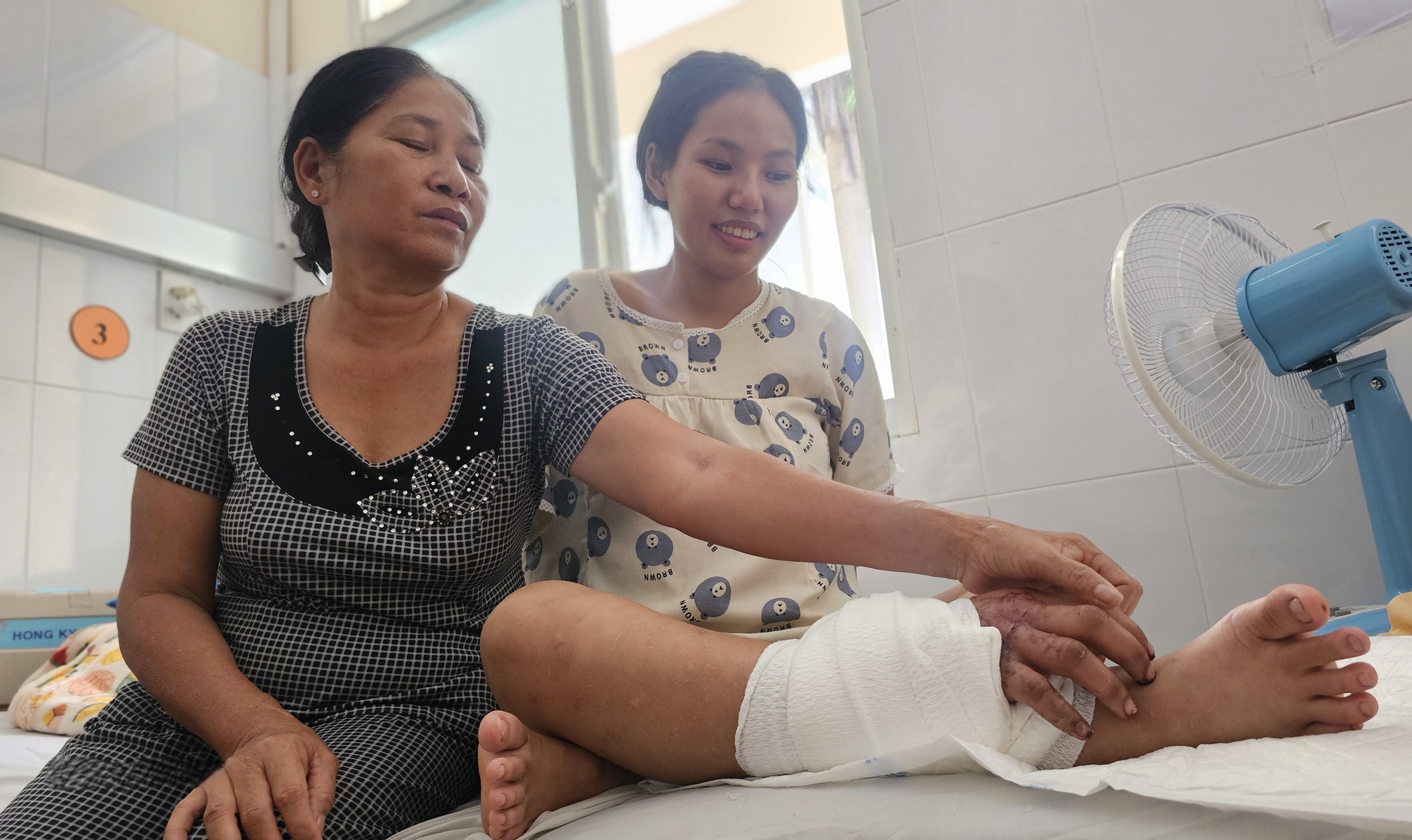 Gh&eacute;p b&agrave;n tay v&agrave;o ch&acirc;n cho c&ocirc; g&aacute;i 18 tuổi mang song thai để chờ ng&agrave;y nối lại- Ảnh 1.