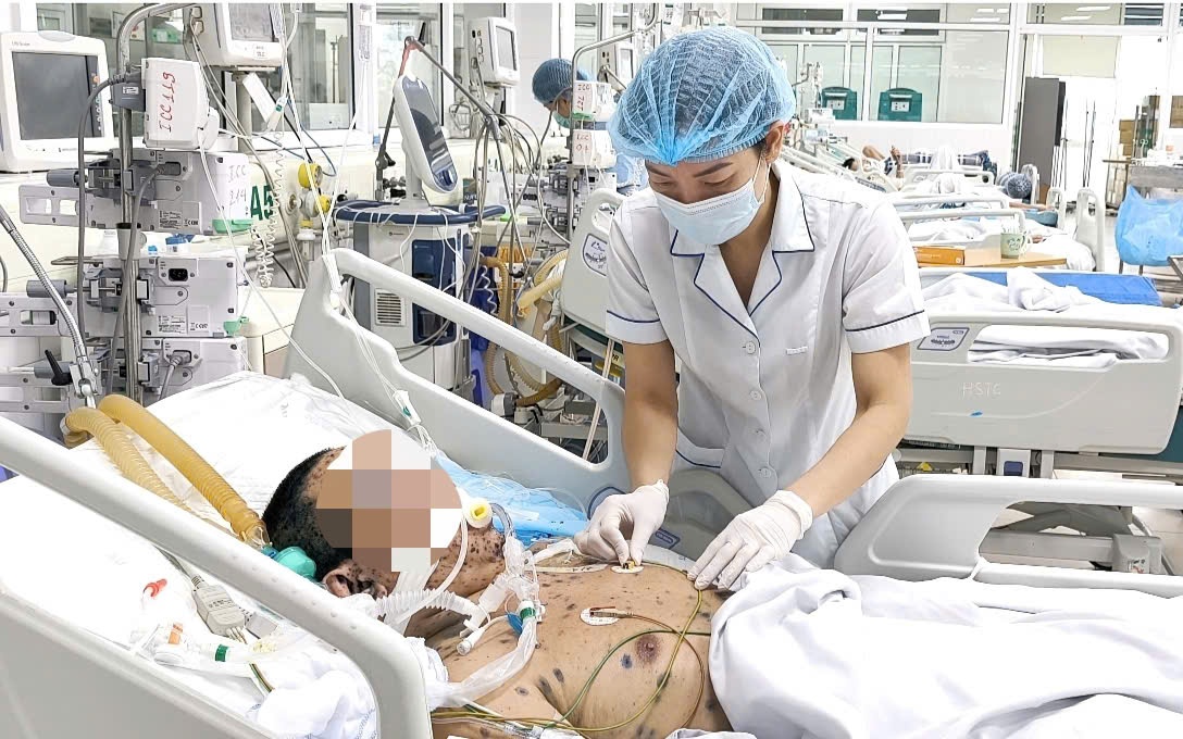 Mắc thủy đậu từ con, người cha 35 tuổi nguy kịch
