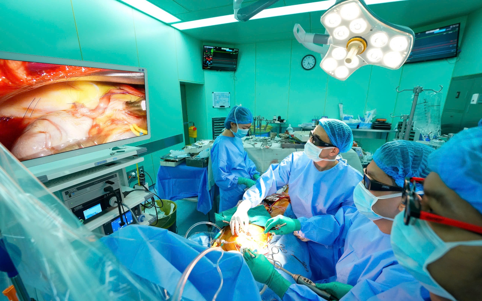 Si&ecirc;u &acirc;m v&uacute; 3D tự động bước tiến mới tầm so&aacute;t ung thư v&uacute; sớm - Ảnh 3.