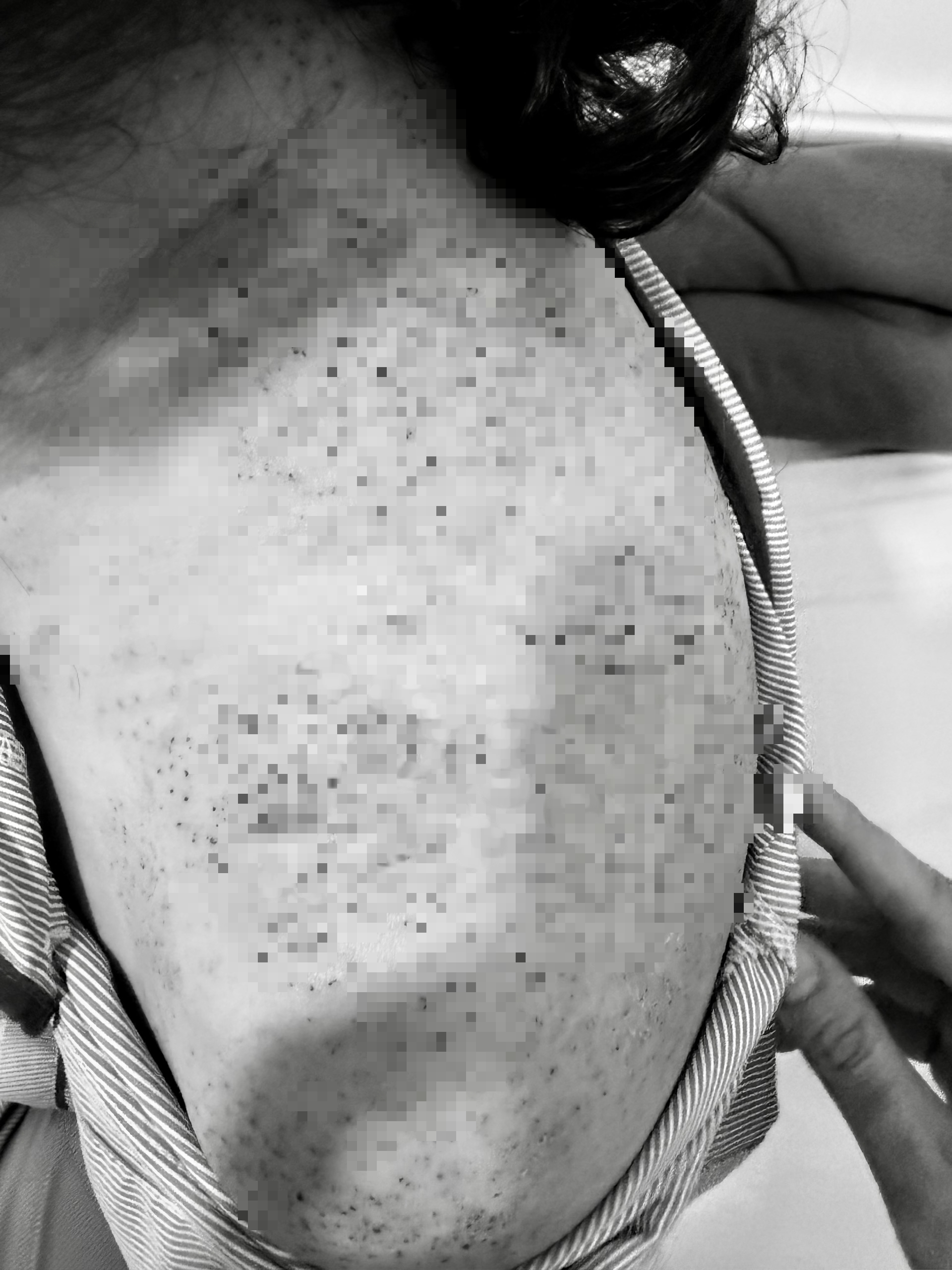 Người phụ nữ ở Vĩnh Long nhập viện cấp cứu sau khi ch&iacute;ch lể, gi&aacute;c hơi - Ảnh 2.