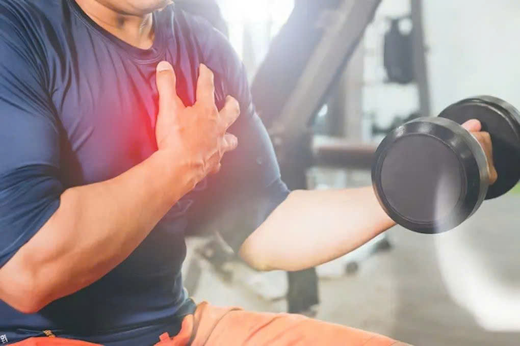 Khi chơi thể thao, c&oacute; những dấu hiệu n&agrave;y n&ecirc;n dừng lại để tr&aacute;nh đột quỵ - Ảnh 1.