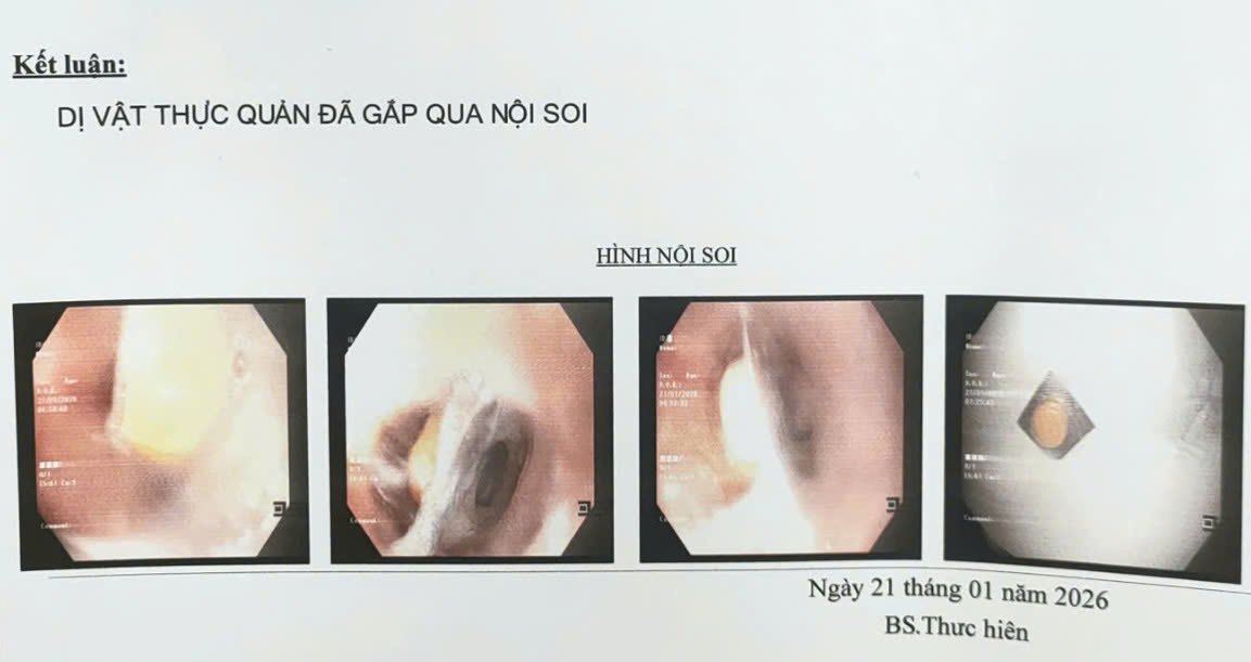 B&aacute;c sĩ cảnh b&aacute;o một hiện tượng nguy hiểm ở người gi&agrave; - Ảnh 1.
