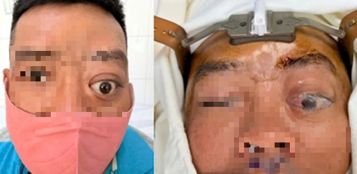 Một người đ&agrave;n &ocirc;ng mắc bệnh hiếm, 20 năm mới gặp 2 ca - Ảnh 1.
