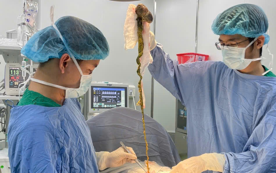 Bé trai phải lên bàn mổ vì ăn tóc, bác sĩ cảnh báo tình trạng y khoa hiếm gặp