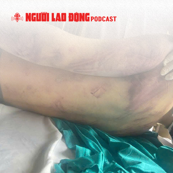Kiểm tra toàn diện Trung tâm Công tác xã hội vụ học viên tử vong sau 2 ngày nhập học