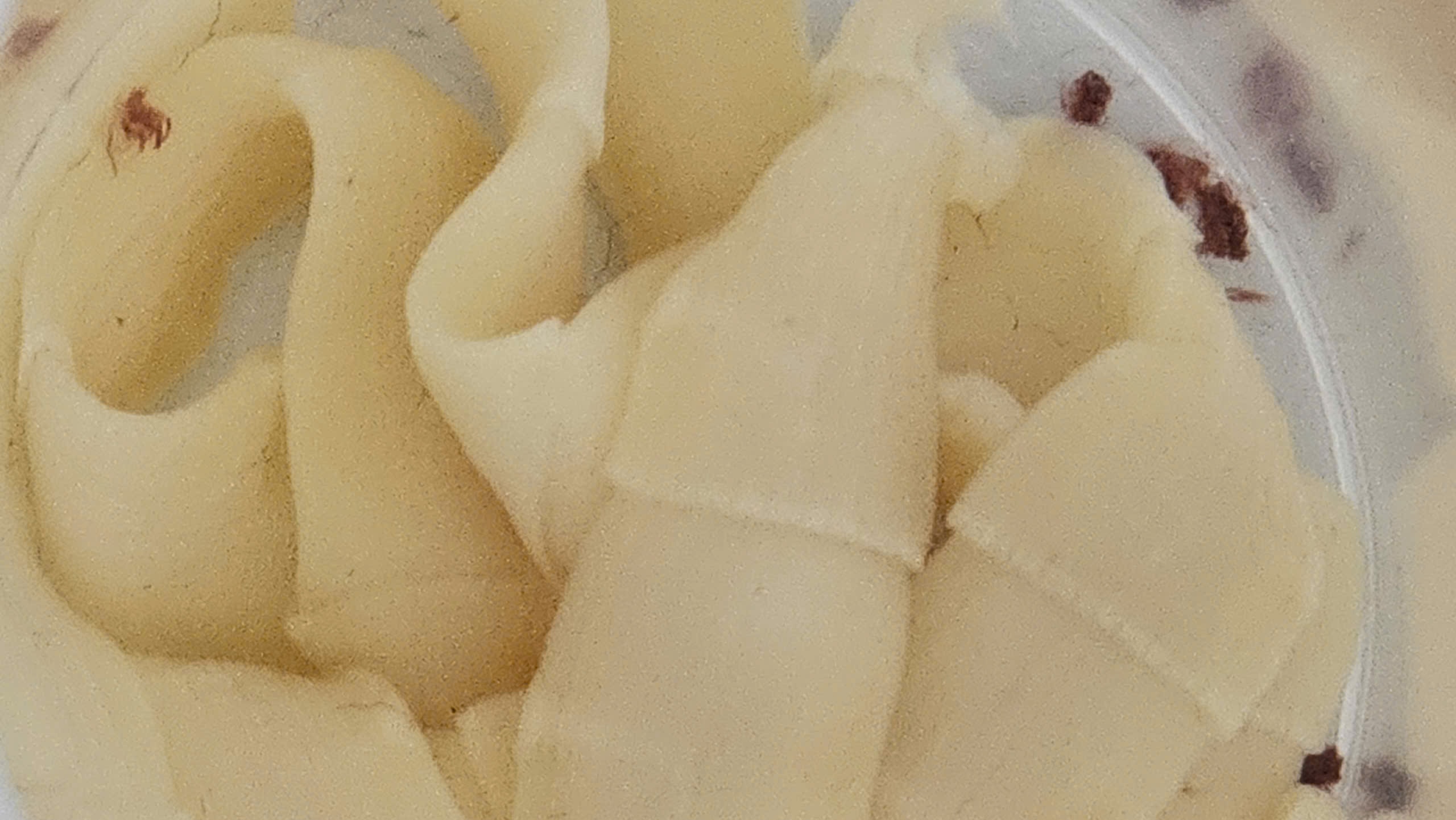 S&aacute;n d&acirc;y d&agrave;i gần 1 m&eacute;t "ngọ nguậy" trong đại tr&agrave;ng người đ&agrave;n &ocirc;ng th&iacute;ch ăn đồ t&aacute;i - Ảnh 4.