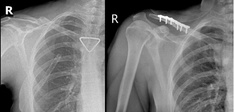 Thêm 1 du khách người Nga được bác sĩ cấp cứu kịp thời - Ảnh 2.