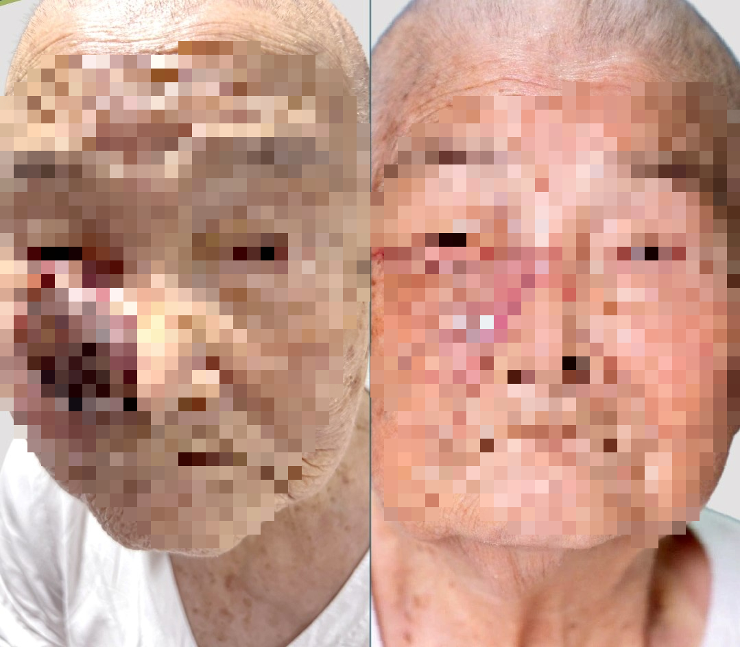 Kỳ t&iacute;ch mang lại nụ cười cho những bệnh nh&acirc;n ngh&egrave;o - Ảnh 5.