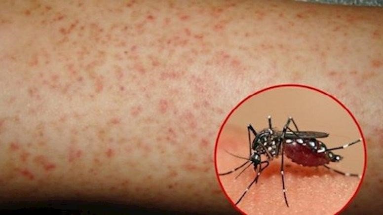 Những bệnh thường gặp khi du xuân - Ảnh 4.