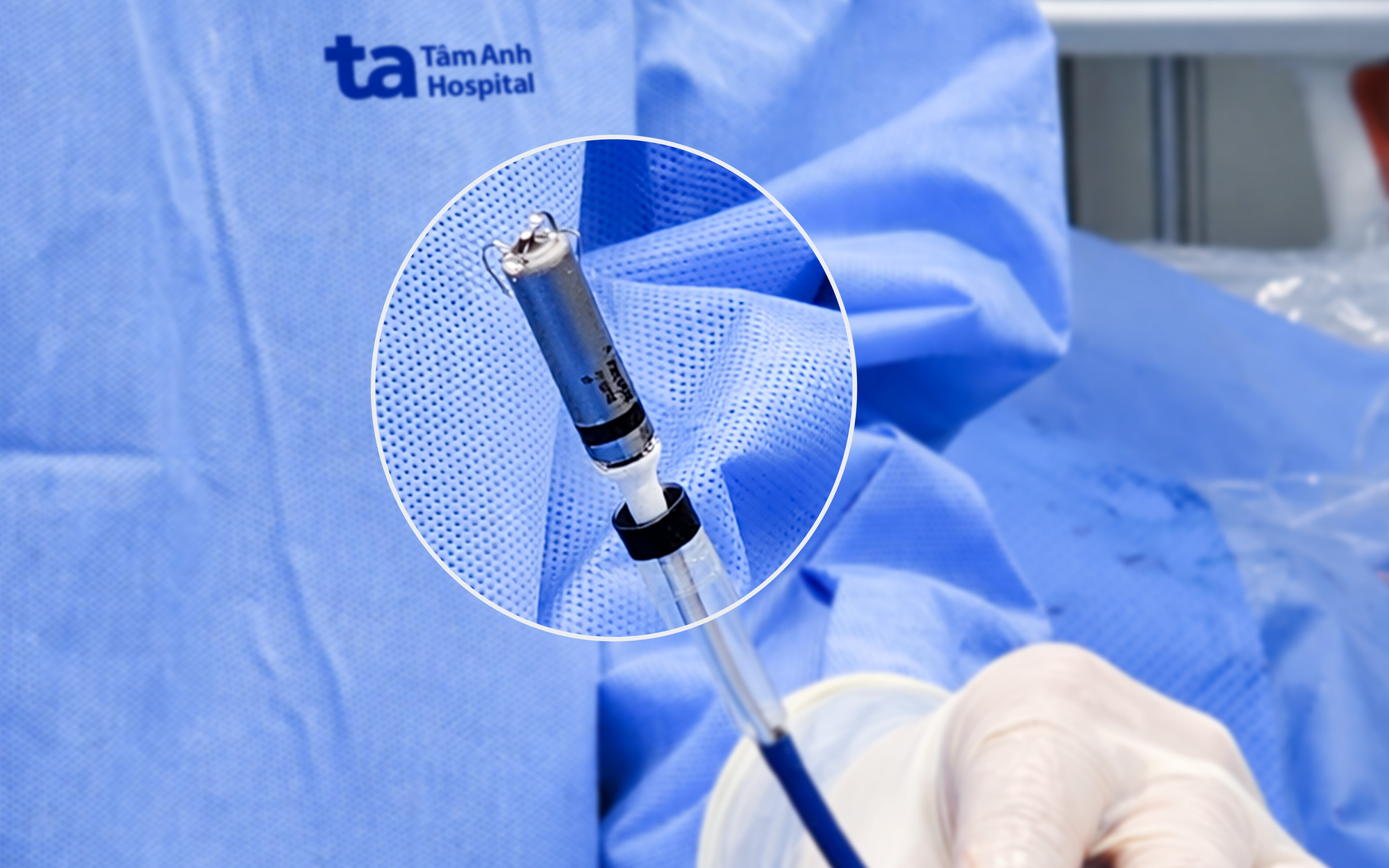 Bệnh viện Tâm Anh triển khai cấy máy tạo nhịp tim không dây thế hệ mới đầu tiên tại Việt Nam