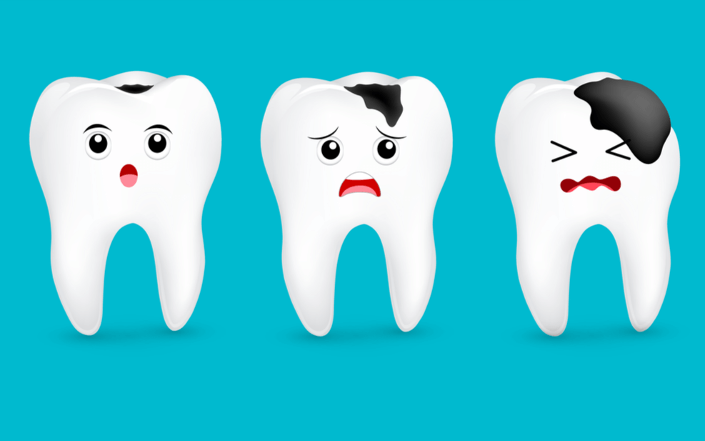 Răng bị sâu, ê buốt có phải do thiểu sản men? - Ảnh 1.