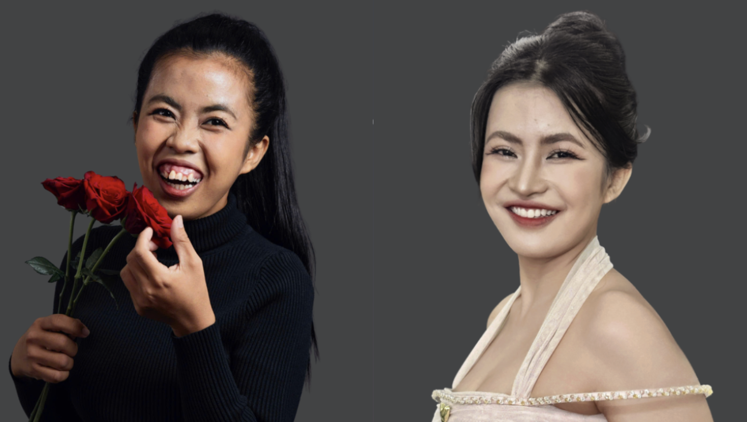 Khi ngoại h&igrave;nh trở th&agrave;nh "r&agrave;o cản v&ocirc; h&igrave;nh" của người trẻ - Ảnh 3.
