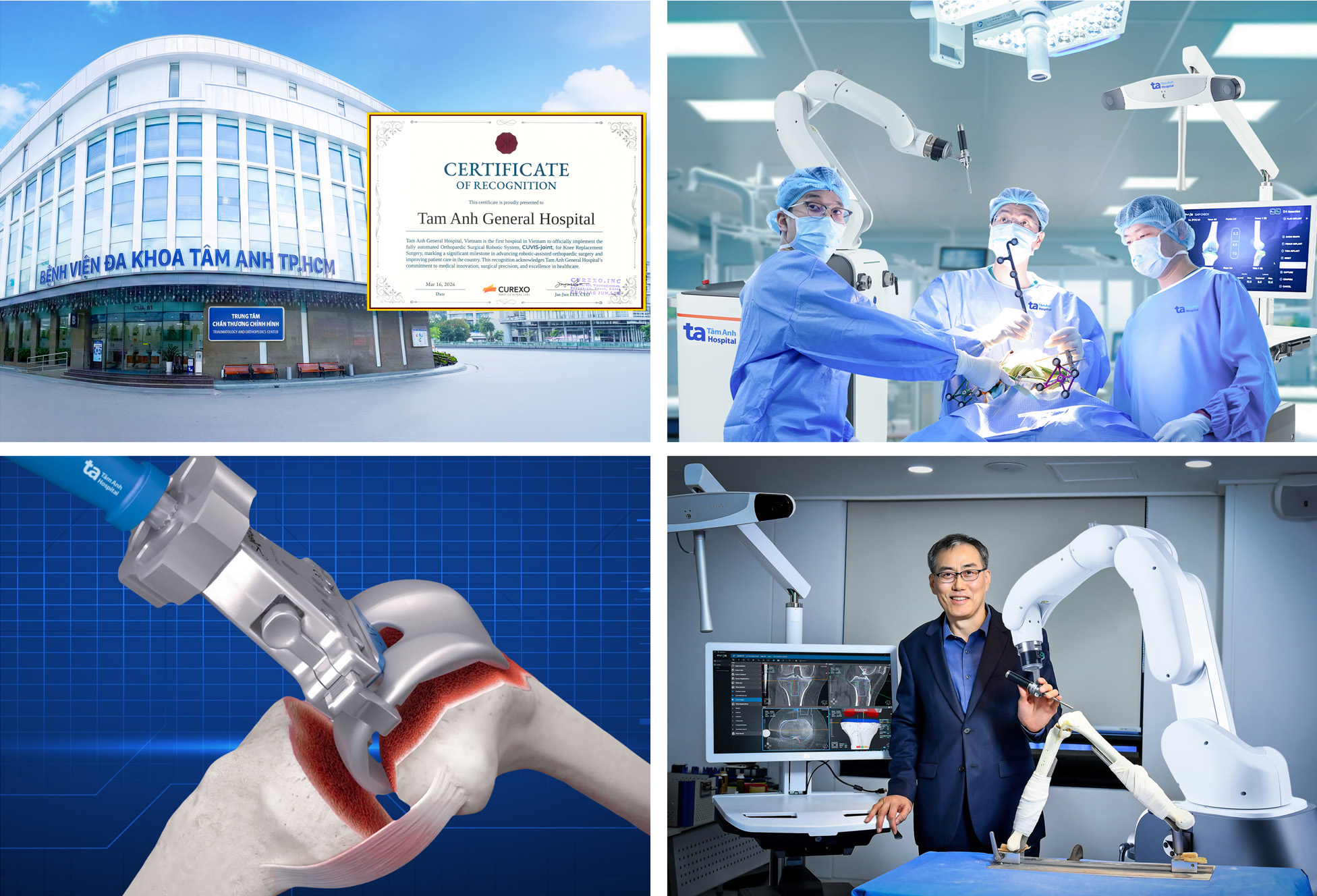 Robot AI thay khớp chuẩn x&aacute;c đến 100% đầu ti&ecirc;n tại Việt Nam - Ảnh 1.