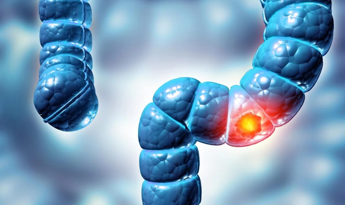 Phát hiện loại virus mới liên quan đến bệnh ung thư - Ảnh 1.
