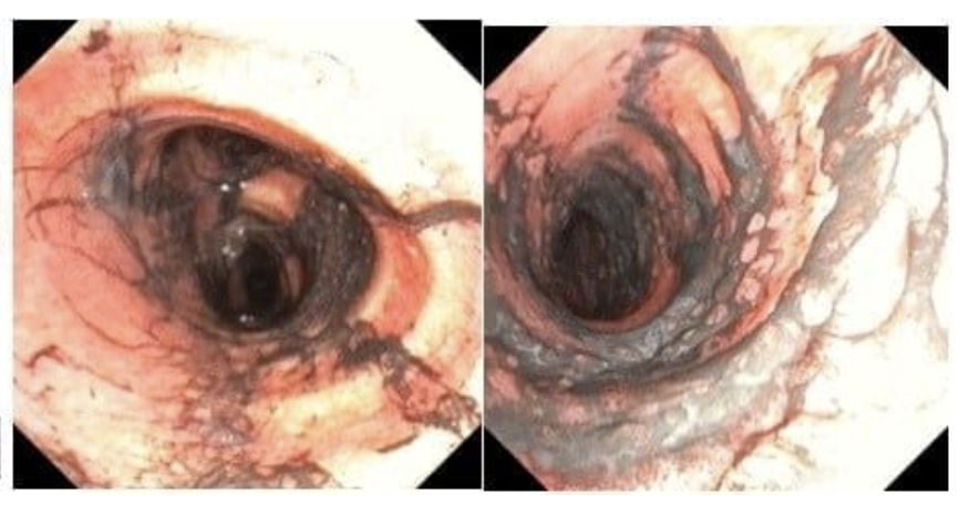 Ngạt khói nặng sau vụ cháy, đôi vợ chồng trẻ được hồi sinh kỳ diệu - Ảnh 1.