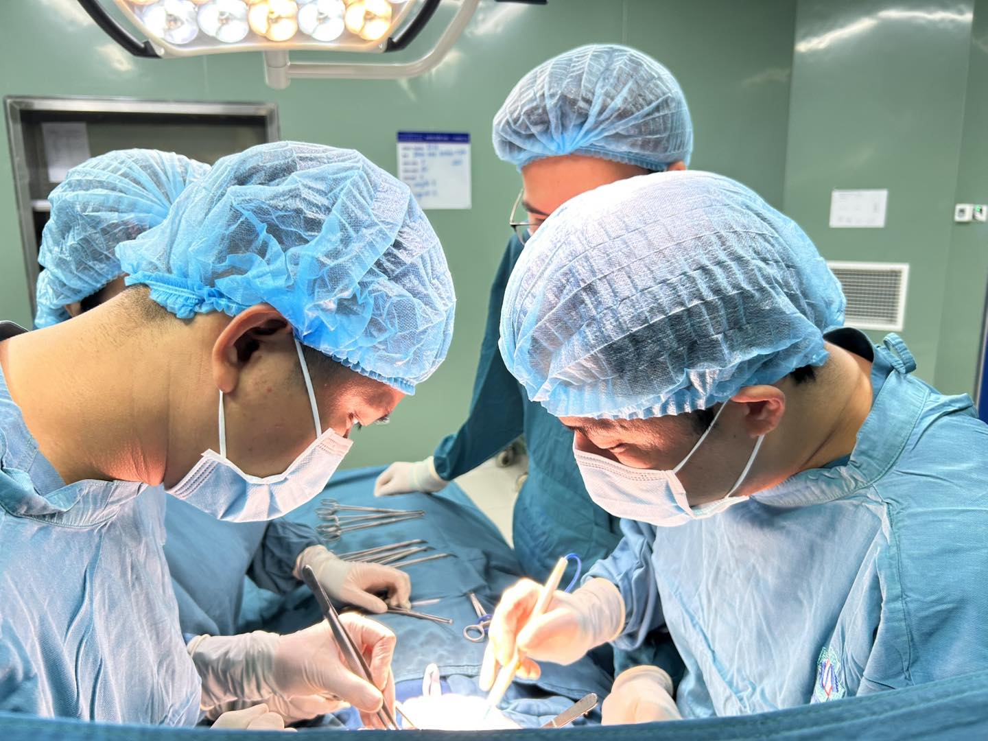 Búi tóc "khủng" trong dạ dày bệnh nhi 7 tuổi - Ảnh 1.