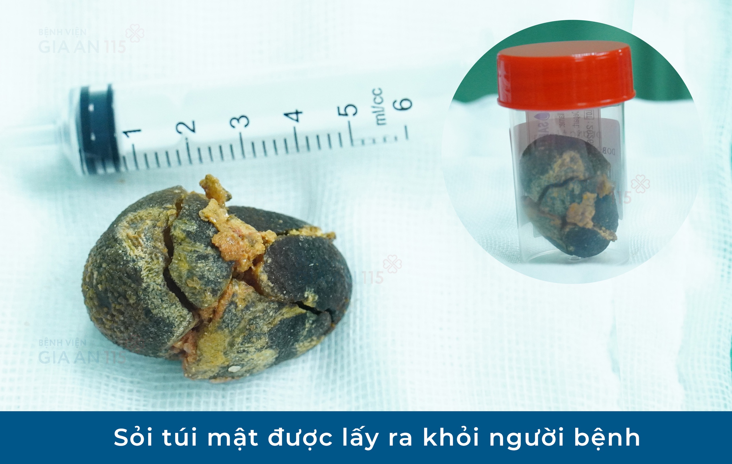 Đi kh&aacute;m sức khỏe định kỳ, người phụ nữ trẻ ph&aacute;t hiện điều bất ngờ - Ảnh 2.