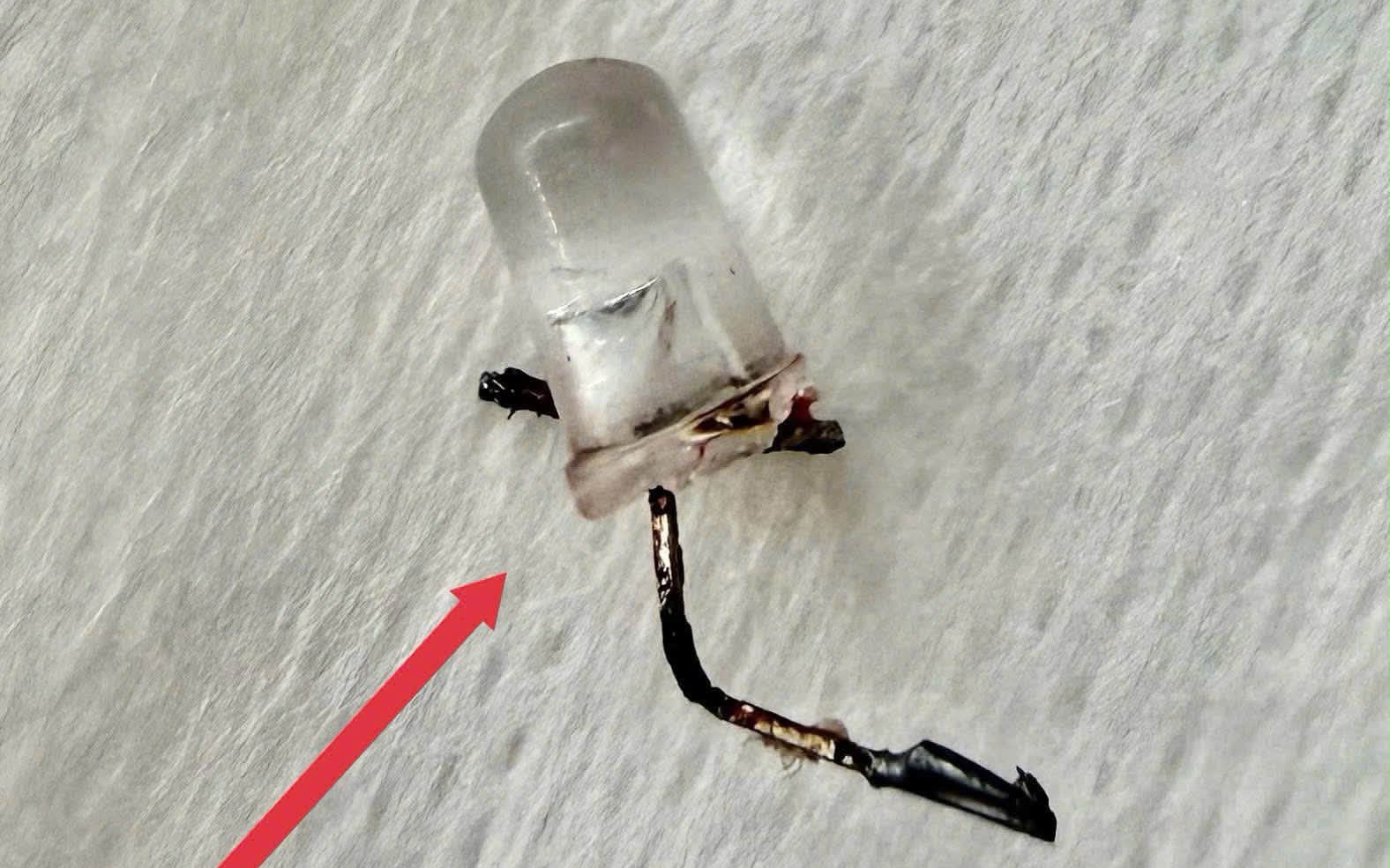 Bác sĩ thót tim gắp đèn LED nằm trong phế quản bé 9 tháng tuổi