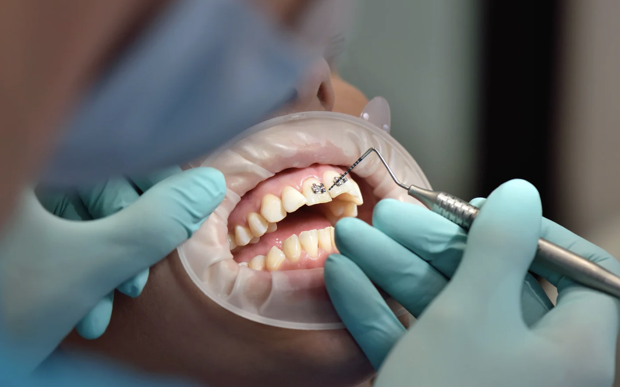 Mỗi hàm răng một phác đồ riêng nhờ nha khoa cá nhân hóa