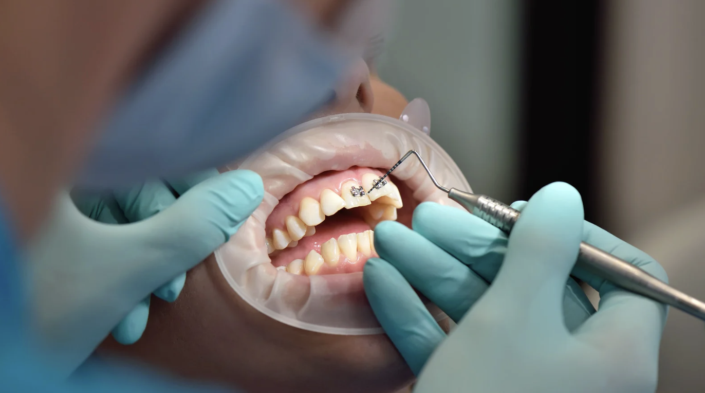 Mỗi hàm răng một phác đồ riêng nhờ nha khoa cá nhân hóa - Ảnh 2.