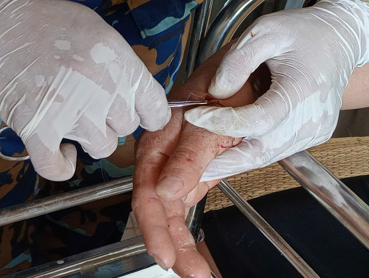 - Ảnh 1.