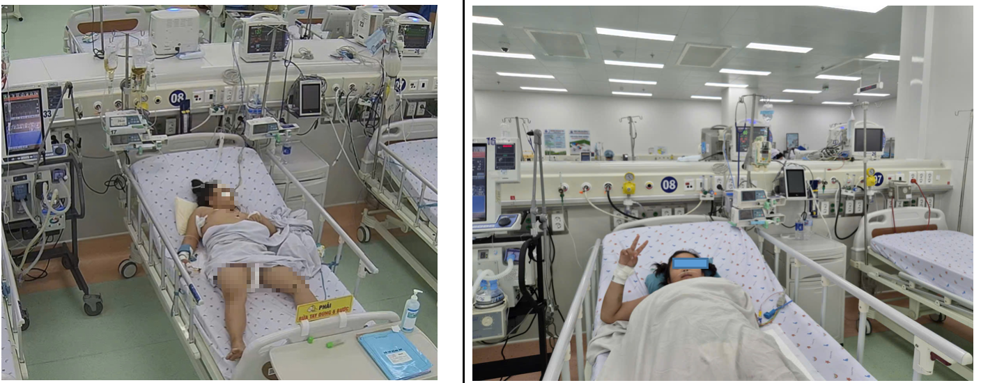 Liên tiếp trẻ nguy kịch vì sốt xuất huyết Dengue nặng, có ca suy gan cấp - Ảnh 1.