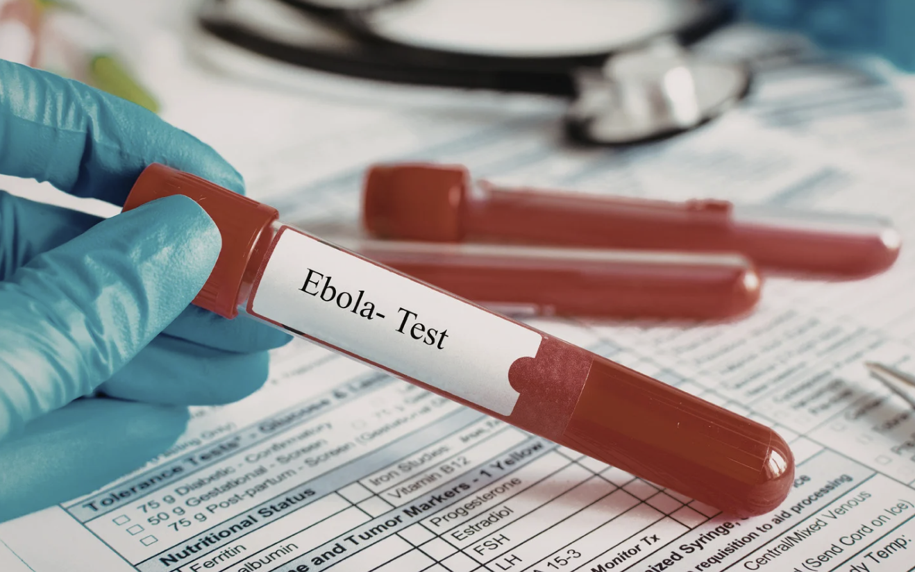 TPHCM tăng cường giám sát cửa khẩu, chủ động phòng nguy cơ dịch bệnh Ebola xâm nhập