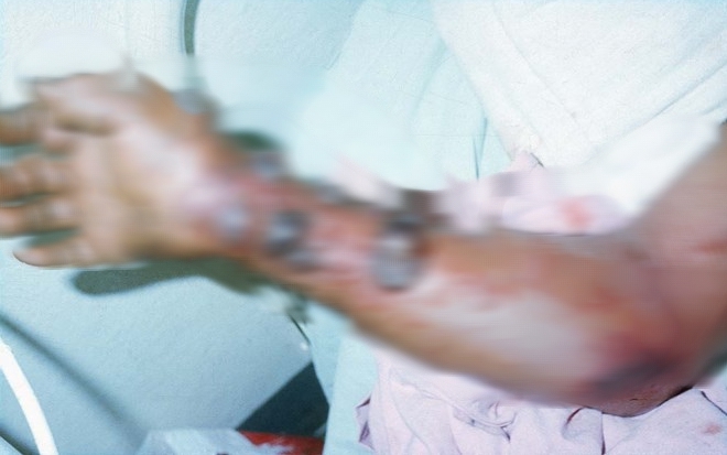 Vì sao WHO đánh giá nguy cơ Ebola vào Việt Nam ở mức thấp?