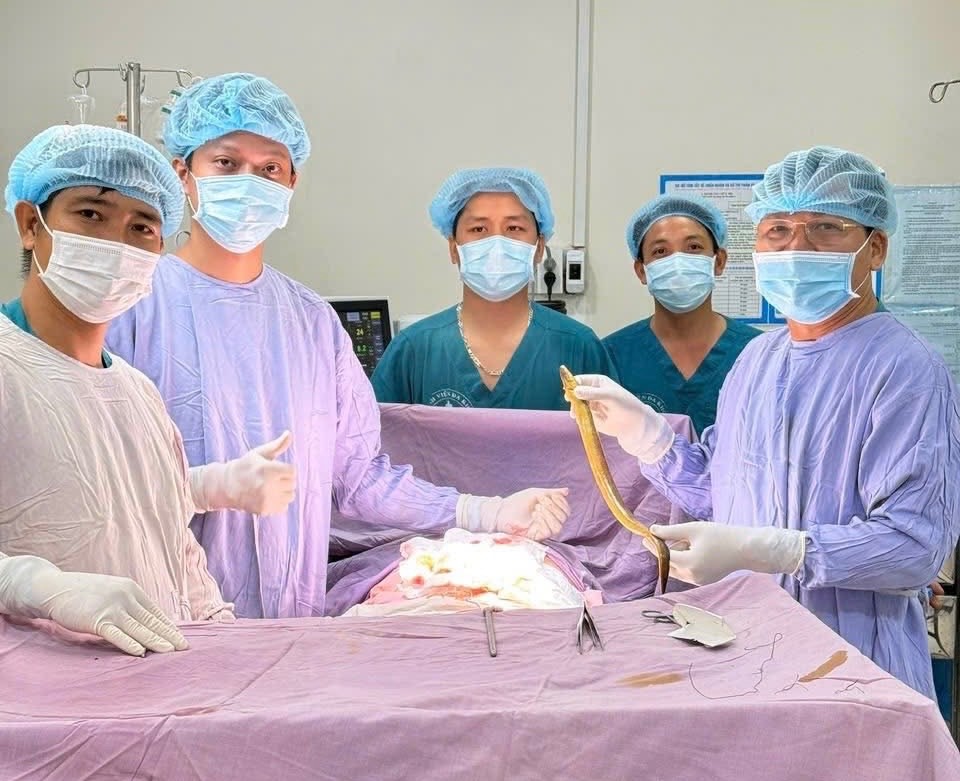 Hy hữu bệnh nhân bị con lươn dài chui vào bụng - Ảnh 1.