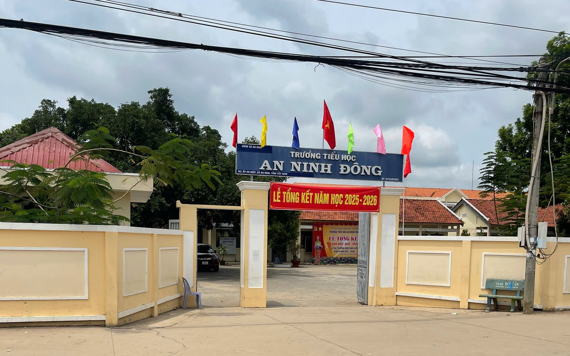 Nam sinh lớp 5 chấn thương sọ não sau khi bạn "tác động" trước ngày nghỉ hè
