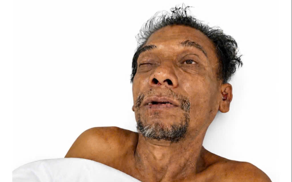 Tìm người thân của cụ ông bị tai nạn nguy kịch ở Tây Ninh