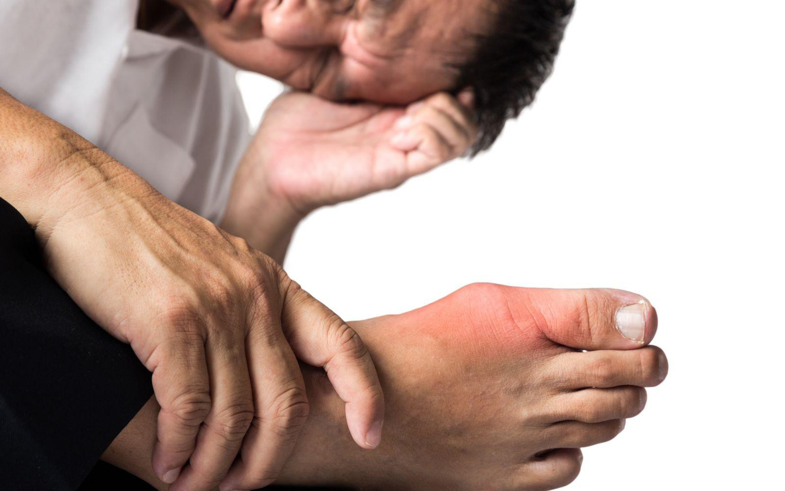 Chuyên gia Harvard: Người bệnh gout nên ăn gì?
