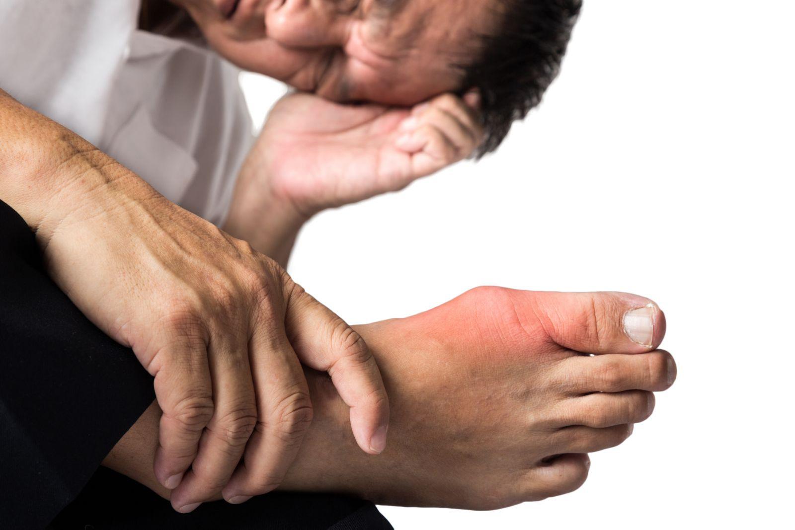 Chuyên gia Harvard: Người bệnh gout nên ăn gì? - Ảnh 1.