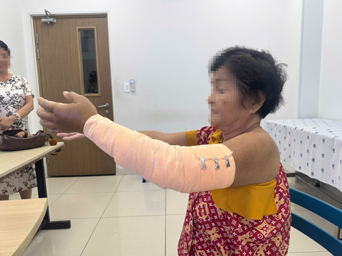 Tàn phế do chủ quan - Ảnh 1.