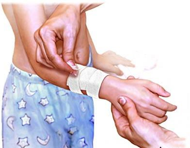 Xác định yếu tố quan trọng làm lành vết thương