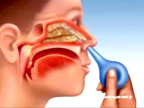 Khám và tư vấn miễn phí các bệnh lý tai – mũi – họng